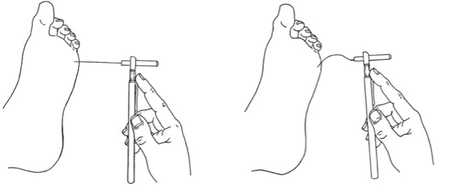 10g (5.07) Semmes-Weinstein monofilament